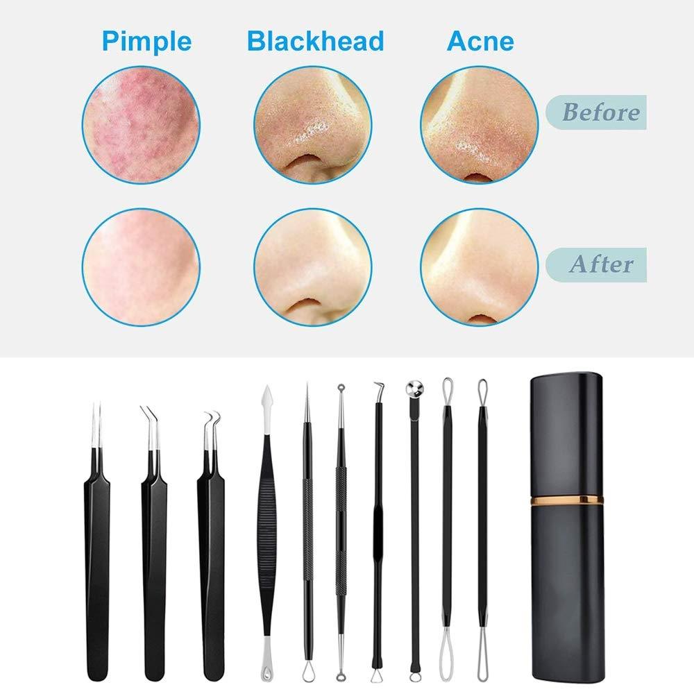 10 Pcs Blackhead Removal Kit Pimple Tool Byshoppy 10-pcs-blackhead-removal-kit-pimple-tool-byshoppy